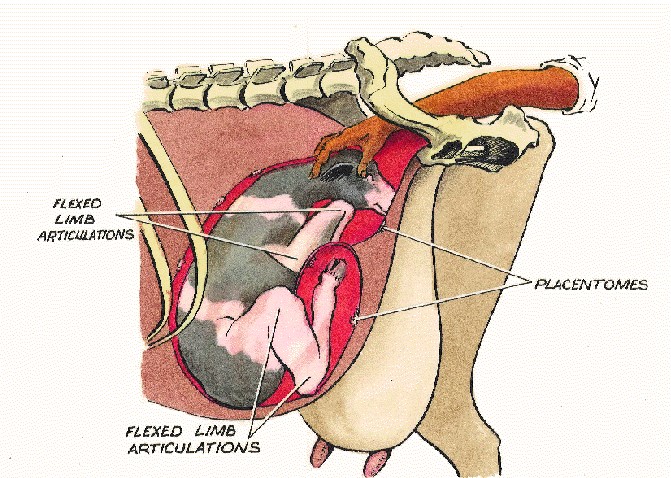 Diagnostic de gestation